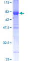 IRF6 Protein - 12.5% SDS-PAGE of human IRF6 stained with Coomassie Blue