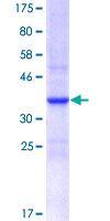 IRF6 Protein - 12.5% SDS-PAGE Stained with Coomassie Blue