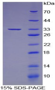 IRF6 Protein - Recombinant Interferon Regulatory Factor 6 By SDS-PAGE