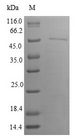 IRGM / LRG-47 Protein - (Tris-Glycine gel) Discontinuous SDS-PAGE (reduced) with 5% enrichment gel and 15% separation gel.