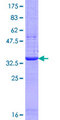 IRGM / LRG-47 Protein - 12.5% SDS-PAGE Stained with Coomassie Blue