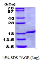 IRGM / LRG-47 Protein