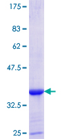 IRS Protein - 12.5% SDS-PAGE Stained with Coomassie Blue.