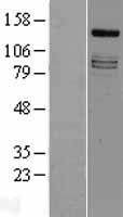 IRS4 Protein - Western validation with an anti-DDK antibody * L: Control HEK293 lysate R: Over-expression lysate