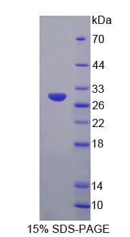 IRS4 Protein - Recombinant Insulin Receptor Substrate 4 (IRS4) by SDS-PAGE