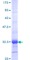 IRX1 Protein - 12.5% SDS-PAGE Stained with Coomassie Blue.