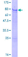 IRX2 Protein - 12.5% SDS-PAGE of human IRX2 stained with Coomassie Blue