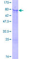 IRX2 Protein - 12.5% SDS-PAGE of human IRX2 stained with Coomassie Blue