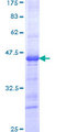 IRX3 Protein - 12.5% SDS-PAGE Stained with Coomassie Blue.