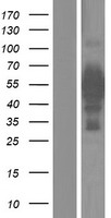 IRX5 Protein - Western validation with an anti-DDK antibody * L: Control HEK293 lysate R: Over-expression lysate