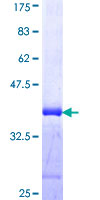 IRX5 Protein - 12.5% SDS-PAGE Stained with Coomassie Blue.