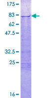 IRX6 Protein - 12.5% SDS-PAGE of human IRX6 stained with Coomassie Blue