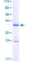 IRX6 Protein - 12.5% SDS-PAGE Stained with Coomassie Blue.