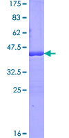 ISA2 / ISCA2 Protein - 12.5% SDS-PAGE of human HBLD1 stained with Coomassie Blue