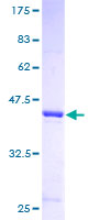 ISCU Protein - 12.5% SDS-PAGE of human NIFUN stained with Coomassie Blue