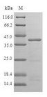 ISCU Protein - (Tris-Glycine gel) Discontinuous SDS-PAGE (reduced) with 5% enrichment gel and 15% separation gel.