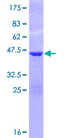 ISG15 Protein - 12.5% SDS-PAGE of human G1P2 stained with Coomassie Blue