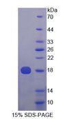 ISG15 Protein - Recombinant  Ubiquitin Cross Reactive Protein By SDS-PAGE