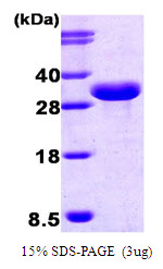 ISG15 Protein