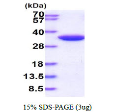 ISG15 Protein