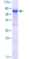 ISG54 / IFIT2 Protein - 12.5% SDS-PAGE of human IFIT2 stained with Coomassie Blue