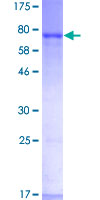 ISGF3 / IRF9 Protein - 12.5% SDS-PAGE of human ISGF3G stained with Coomassie Blue