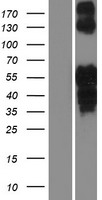 ISL2 / Islet 2 Protein - Western validation with an anti-DDK antibody * L: Control HEK293 lysate R: Over-expression lysate