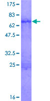ISL2 / Islet 2 Protein - 12.5% SDS-PAGE of human ISL2 stained with Coomassie Blue