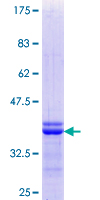 ISL2 / Islet 2 Protein - 12.5% SDS-PAGE Stained with Coomassie Blue.