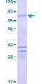 ISLET-1 / ISL1 Protein - 12.5% SDS-PAGE of human ISL1 stained with Coomassie Blue