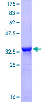 ISLET-1 / ISL1 Protein - 12.5% SDS-PAGE Stained with Coomassie Blue.
