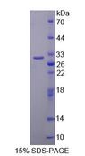 ISLET-1 / ISL1 Protein - Recombinant ISL LIM Homeobox Protein 1 By SDS-PAGE