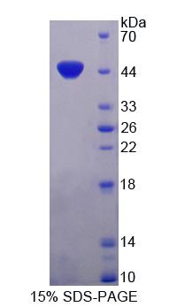 ISLR Protein - Recombinant  Immunoglobulin Superfamily Containing Leucine Rich Repeat Protein By SDS-PAGE