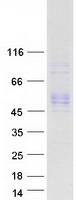 ISLR Protein - Purified recombinant protein ISLR was analyzed by SDS-PAGE gel and Coomassie Blue Staining