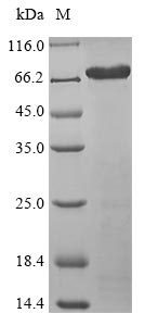 ISM1 Protein - (Tris-Glycine gel) Discontinuous SDS-PAGE (reduced) with 5% enrichment gel and 15% separation gel.