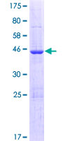 ISOC2 Protein - 12.5% SDS-PAGE of human ISOC2 stained with Coomassie Blue