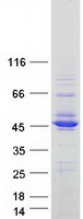 ISPD / Nip Protein - Purified recombinant protein ISPD was analyzed by SDS-PAGE gel and Coomassie Blue Staining