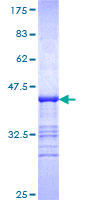 ISYNA1 Protein - 12.5% SDS-PAGE Stained with Coomassie Blue.
