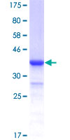 ITCH / AIP4 Protein - 12.5% SDS-PAGE Stained with Coomassie Blue.