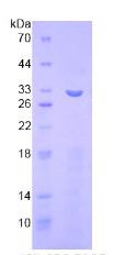ITFG1 / TIP Protein - Recombinant Integrin Alpha FG GAP Repeat Containing Protein 1 By SDS-PAGE