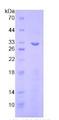 ITFG1 / TIP Protein - Recombinant Integrin Alpha FG GAP Repeat Containing Protein 1 By SDS-PAGE
