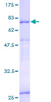 ITFG2 Protein - 12.5% SDS-PAGE of human MDS028 stained with Coomassie Blue