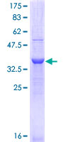 ITGA11 / Integrin Alpha 11 Protein - 12.5% SDS-PAGE Stained with Coomassie Blue.