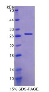 ITGA11 / Integrin Alpha 11 Protein - Recombinant Integrin Alpha 11 (ITGa11) by SDS-PAGE