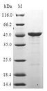 ITGA2 / CD49b Protein - (Tris-Glycine gel) Discontinuous SDS-PAGE (reduced) with 5% enrichment gel and 15% separation gel.
