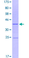 ITGA2 / CD49b Protein - 12.5% SDS-PAGE Stained with Coomassie Blue.