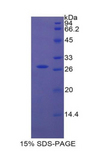 ITGA2 / CD49b Protein - Recombinant Integrin Alpha 2 By SDS-PAGE