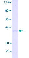 ITGA2B / CD41 Protein - 12.5% SDS-PAGE Stained with Coomassie Blue.