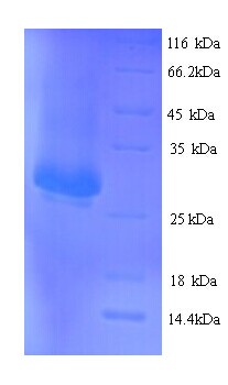 ITGA2B / CD41 Protein