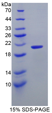 ITGA2B / CD41 Protein - Recombinant  Integrin Alpha 2B By SDS-PAGE